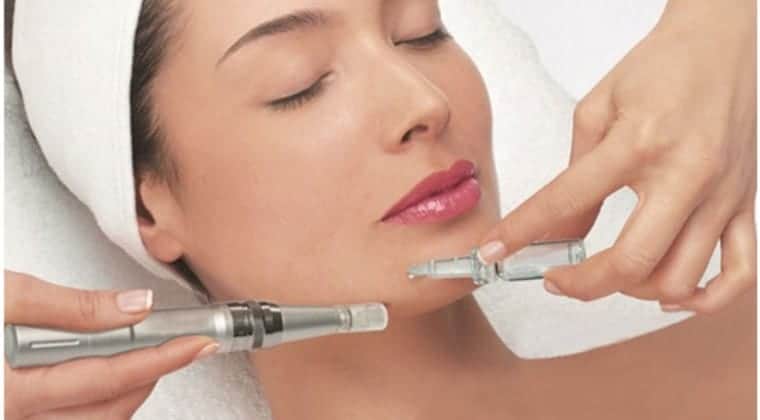 Microneedling