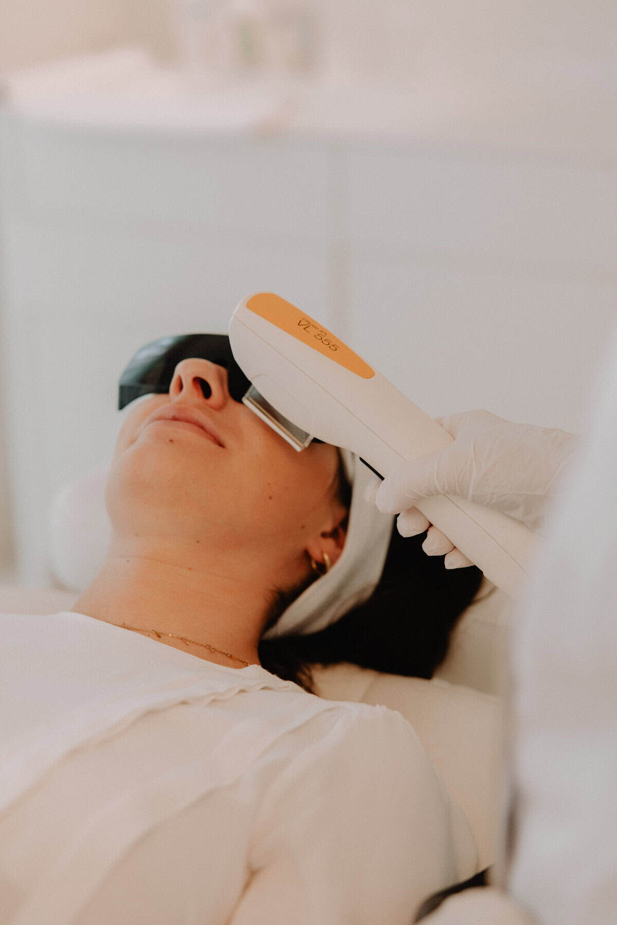 IPL – gezicht bij Beautyhouse Rotterdam
