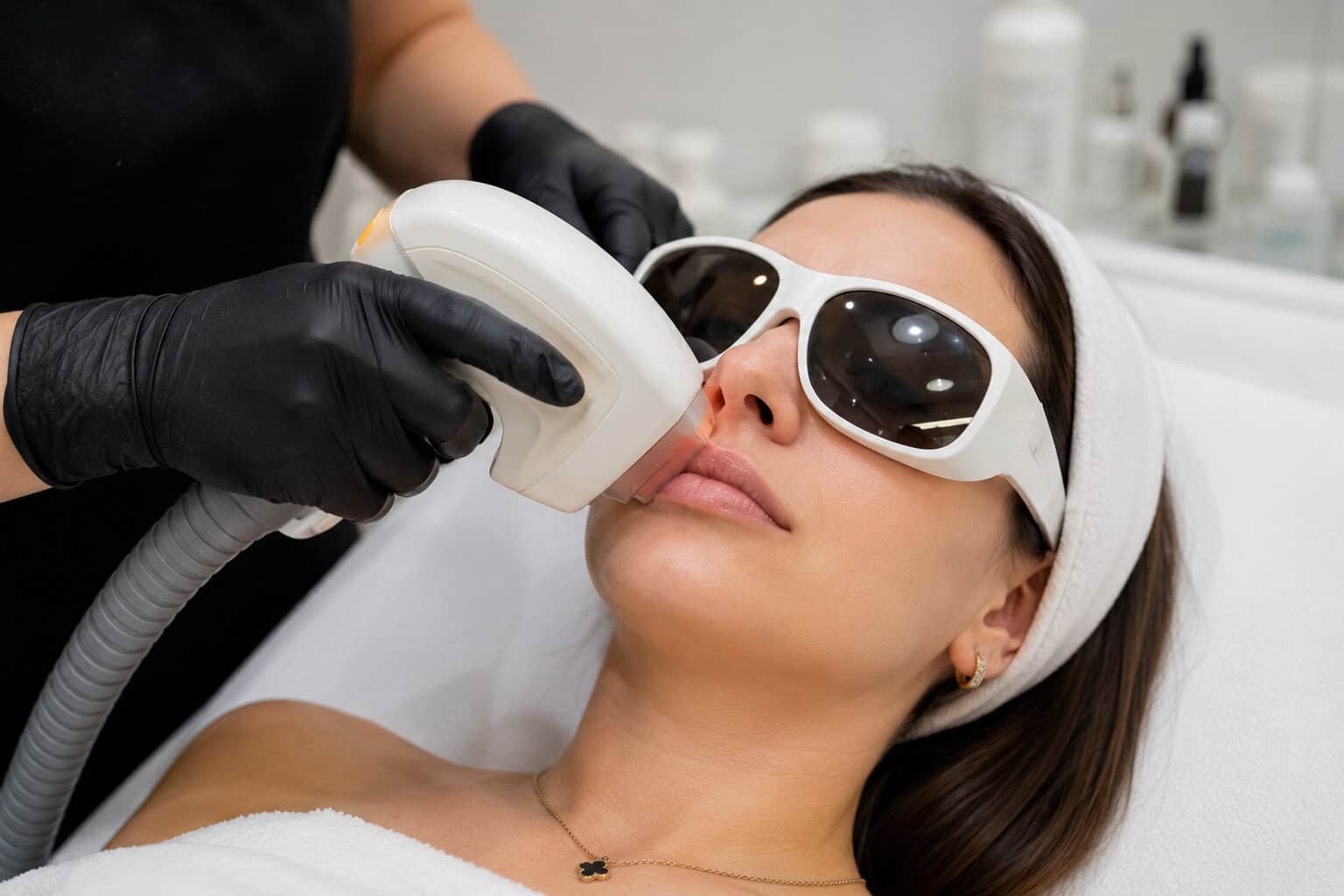 IPL- bovenlip bij Beautyhouse Rotterdam