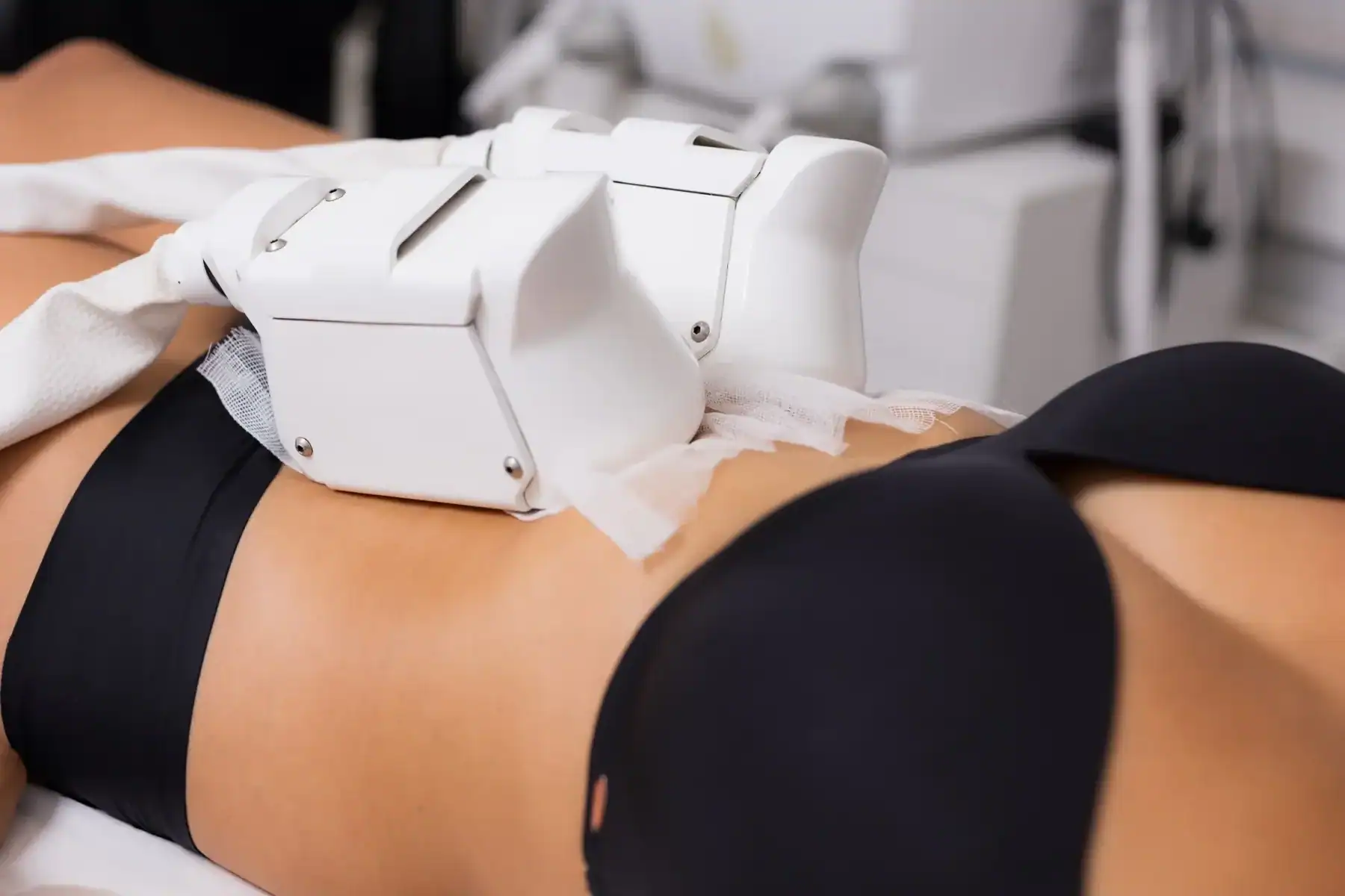 Cryolipolyse 1 zone AKTIE - Beautyhouse Rotterdam
