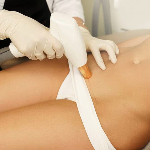 IPL- brazilian vrouw