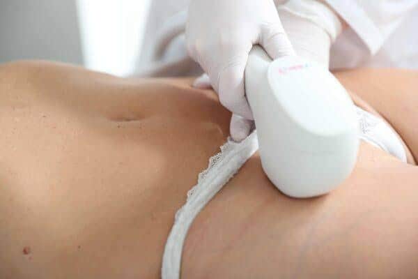 IPL – Bikinilijn bij Beautyhouse Rotterdam