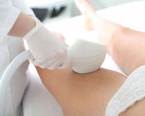 IPL – Onderbenen