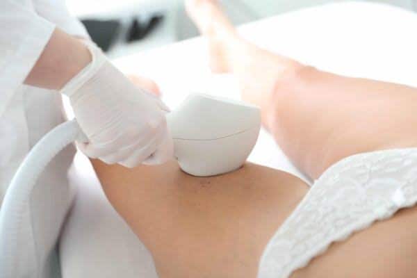IPL – Onderbenen bij Beautyhouse Rotterdam