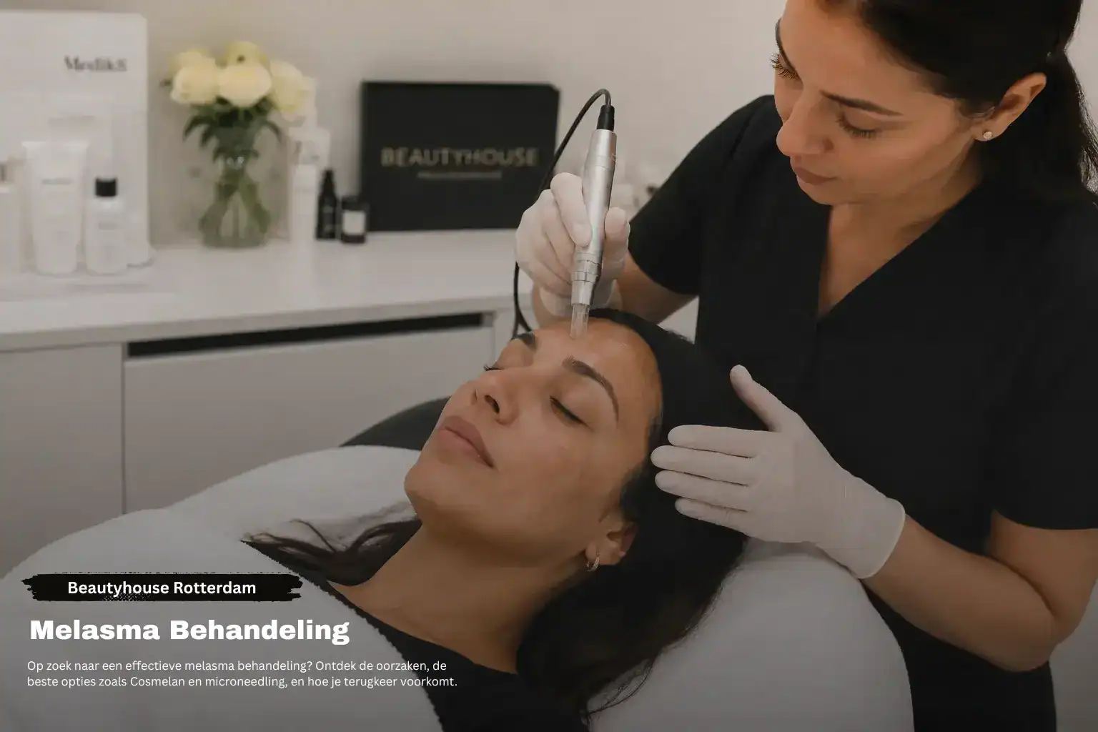 Behandeling van melasma: alles over de oorzaak, aanpak en het voorkomen van terugval