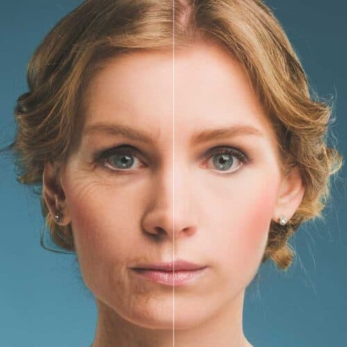 Natural Facelift & LED Therapie