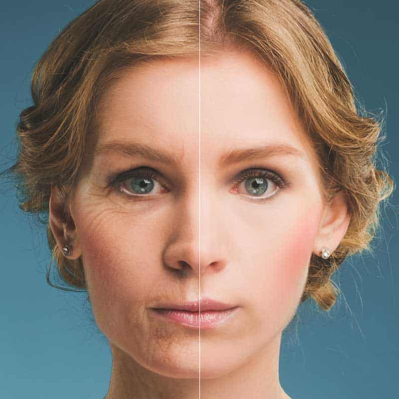 Natural Facelift & LED Therapie bij Beautyhouse Rotterdam