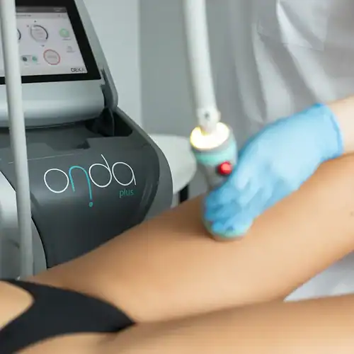 Onda Coolwaves treatment: the solution against cellulite and stubborn fat?