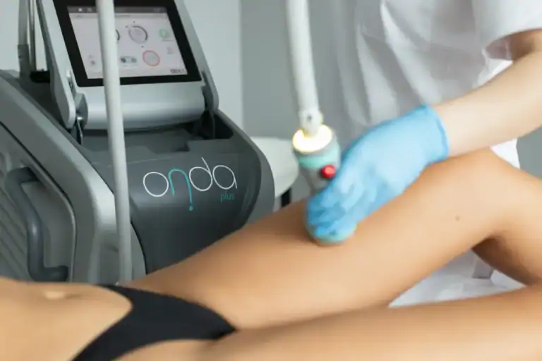 Onda Coolwaves treatment: the solution against cellulite and stubborn fat?
