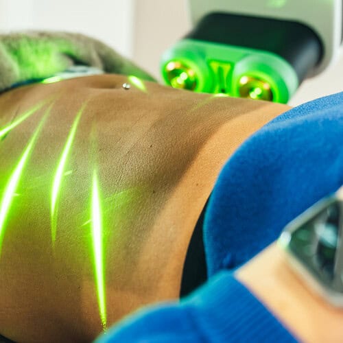 Groene lipolaser per zone actie