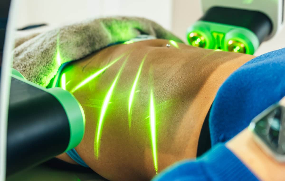 Groene lipolaser per zone actie - Beautyhouse Rotterdam