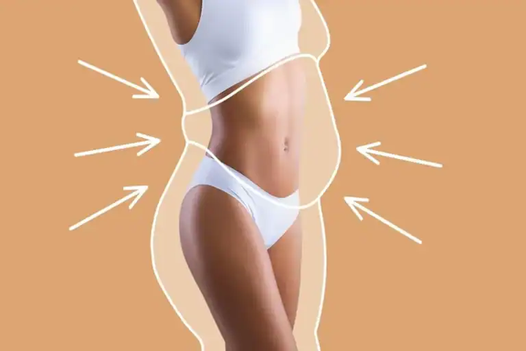 Body Contouring Rotterdam: De Ultieme Oplossing voor Hardnekkig Vet
