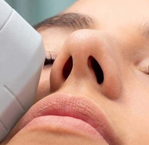 HIFU anti-ageing behandeling - Beautyhouse Rotterdam